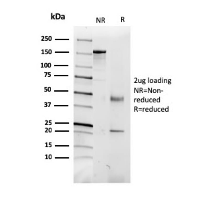 SDS-PAGE - Anti-CD5L Antibody [CD5L/2991] (A250537) - Antibodies.com