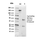 SDS-PAGE - Anti-CD5L Antibody [CD5L/2991] (A250537) - Antibodies.com