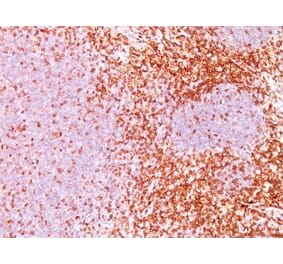 Immunohistochemistry - Anti-CD6 Antibody [3F7B5] (A250538) - Antibodies.com