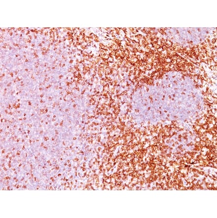 Immunohistochemistry - Anti-CD6 Antibody [3F7B5] (A250538) - Antibodies.com