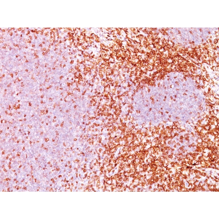 Immunohistochemistry - Anti-CD6 Antibody [3F7B5] (A250538) - Antibodies.com