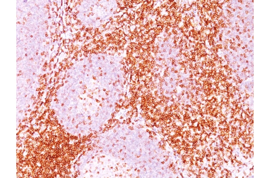 Immunohistochemistry - Anti-CD6 Antibody [3F7B5] (A250538) - Antibodies.com