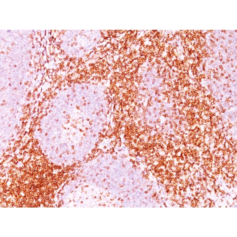 Immunohistochemistry - Anti-CD6 Antibody [3F7B5] (A250538) - Antibodies.com