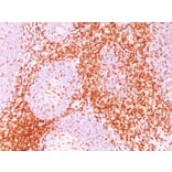 Immunohistochemistry - Anti-CD6 Antibody [3F7B5] (A250538) - Antibodies.com
