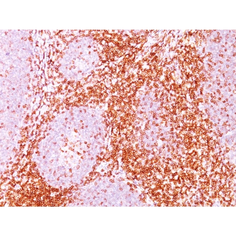 Immunohistochemistry - Anti-CD11 Antibody [C6/372] (A250539) - Antibodies.com