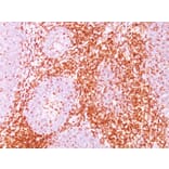 Immunohistochemistry - Anti-CD11 Antibody [C6/372] (A250539) - Antibodies.com