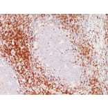 Immunohistochemistry - Anti-CD9 Antibody [SPM547] (A250540) - Antibodies.com