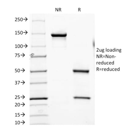 SDS-PAGE - Anti-CD7 Antibody [SPV-L14] (A250541) - Antibodies.com