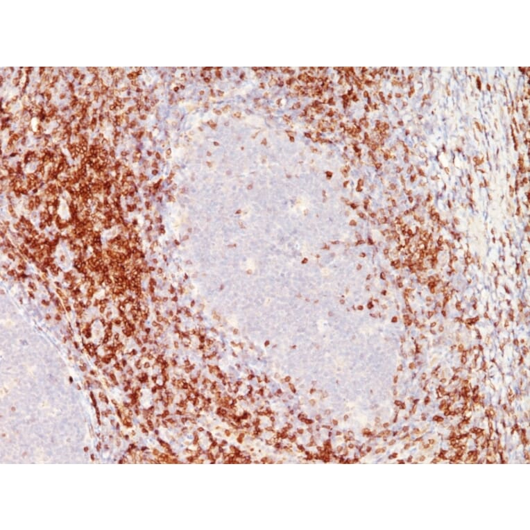 Immunohistochemistry - Anti-CD10 Antibody [C6/372+3F7B5] (A250542) - Antibodies.com