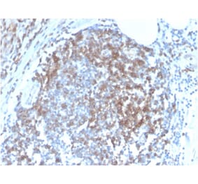 Immunohistochemistry - Anti-CD6 Antibody [C6/2884R] (A250543) - Antibodies.com
