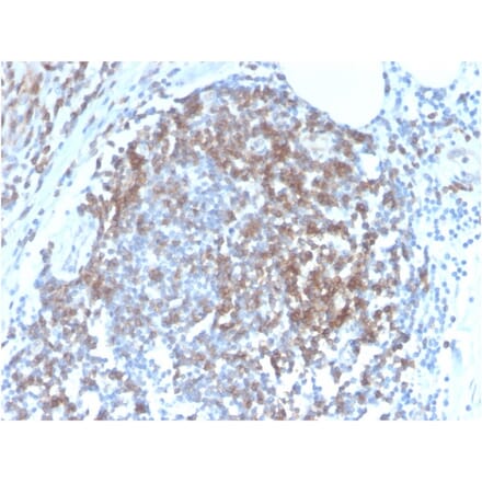 Immunohistochemistry - Anti-CD6 Antibody [C6/2884R] (A250543) - Antibodies.com