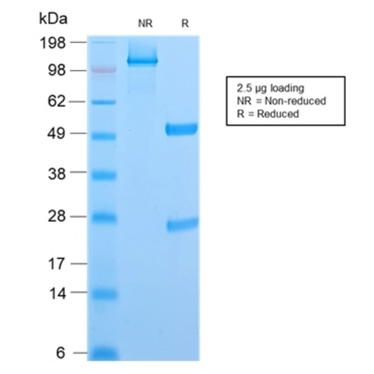 SDS-PAGE - Anti-CD6 Antibody [C6/2884R] (A250543) - Antibodies.com