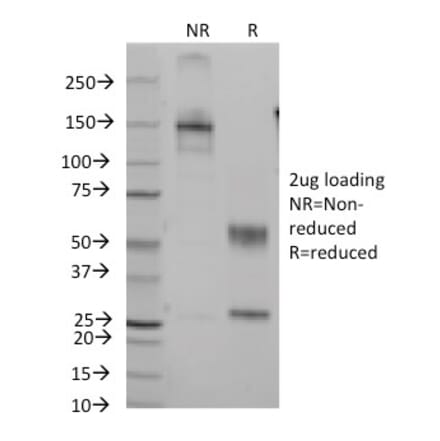 SDS-PAGE - Anti-CD7 Antibody [B-F12] (A250543) - Antibodies.com