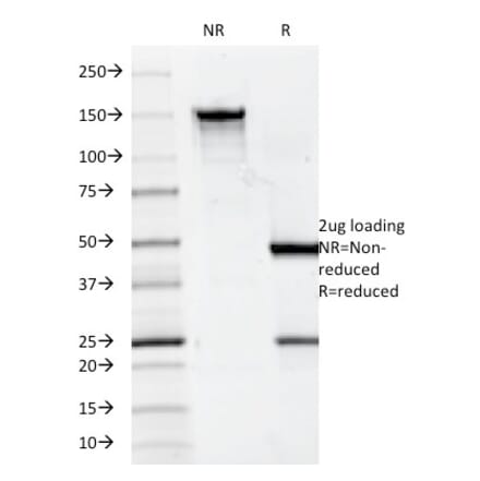 SDS-PAGE - Anti-CD7 Antibody [124-1D1] (A250544) - Antibodies.com