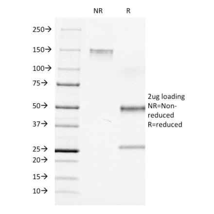 SDS-PAGE - Anti-CD7 Antibody [C7/511] (A250546) - Antibodies.com