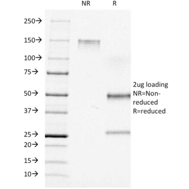 SDS-PAGE - Anti-CD7 Antibody [C7/511] (A250546) - Antibodies.com