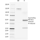 SDS-PAGE - Anti-CD7 Antibody [C7/511] (A250546) - Antibodies.com