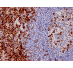 Immunohistochemistry - Anti-CD7 Antibody [CD7/3737] (A250549) - Antibodies.com