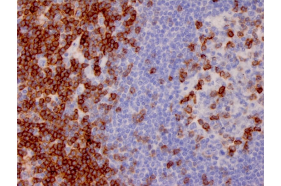 Immunohistochemistry - Anti-CD7 Antibody [CD7/3737] (A250549) - Antibodies.com