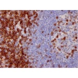 Immunohistochemistry - Anti-CD7 Antibody [CD7/3737] (A250549) - Antibodies.com