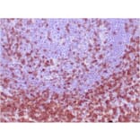 Immunohistochemistry - Anti-CD7 Antibody [CD7/3737] (A250549) - Antibodies.com