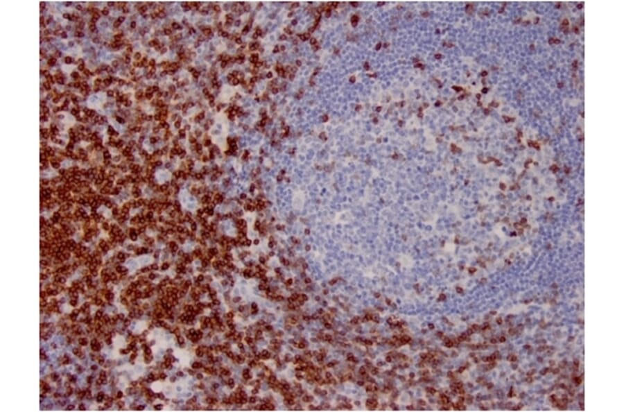 Immunohistochemistry - Anti-CD7 Antibody [CD7/3737] (A250547) - Antibodies.com