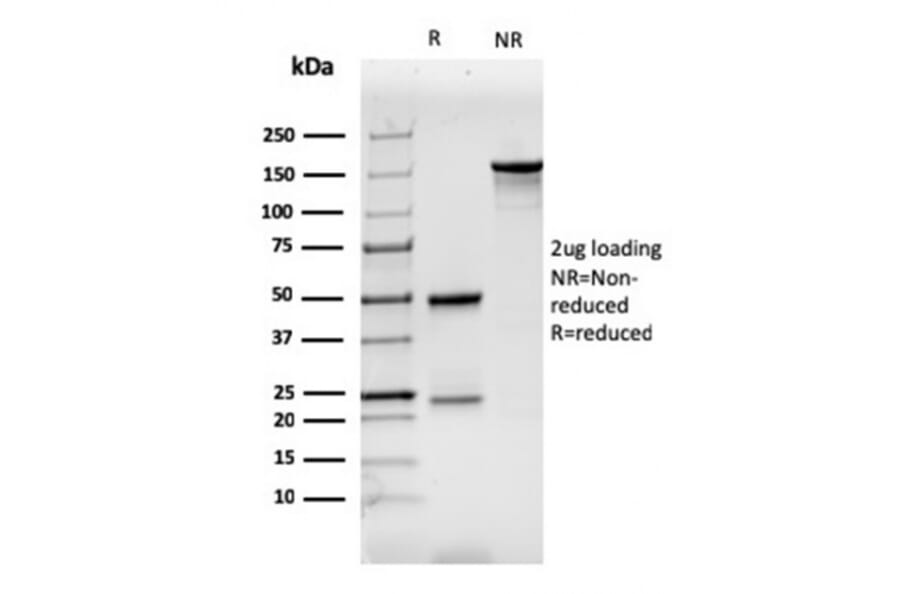 SDS-PAGE - Anti-CD7 Antibody [CD7/3737] (A250549) - Antibodies.com