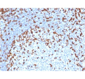 Immunohistochemistry - Anti-CD7 Antibody [rCD7/6387] (A250549) - Antibodies.com