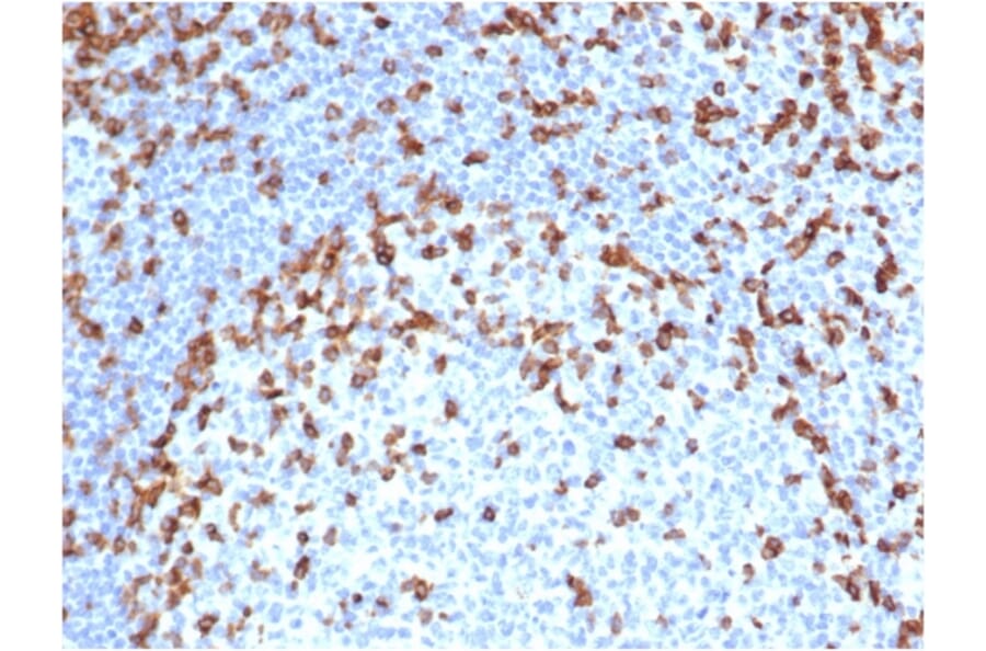Immunohistochemistry - Anti-CD7 Antibody [rCD7/6387] (A250549) - Antibodies.com