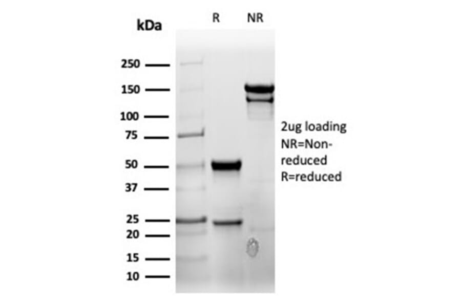 SDS-PAGE - Anti-CD7 Antibody [rCD7/6387] (A250550) - Antibodies.com