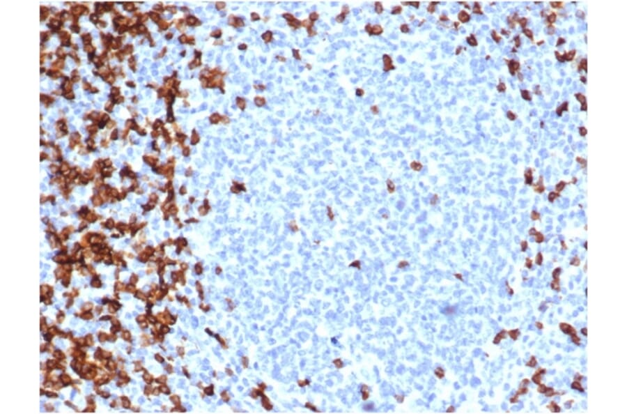 Immunohistochemistry - Anti-CD7 Antibody [CD7/6388R] (A250550) - Antibodies.com