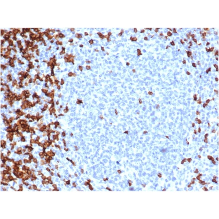 Immunohistochemistry - Anti-CD7 Antibody [CD7/6388R] (A250550) - Antibodies.com