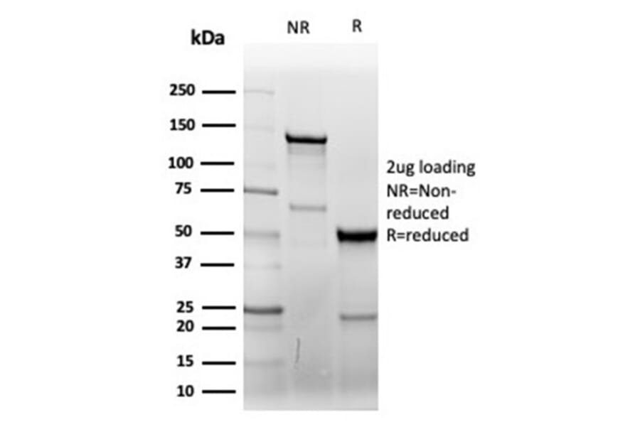 SDS-PAGE - Anti-CD7 Antibody [CD7/6388R] (A250551) - Antibodies.com