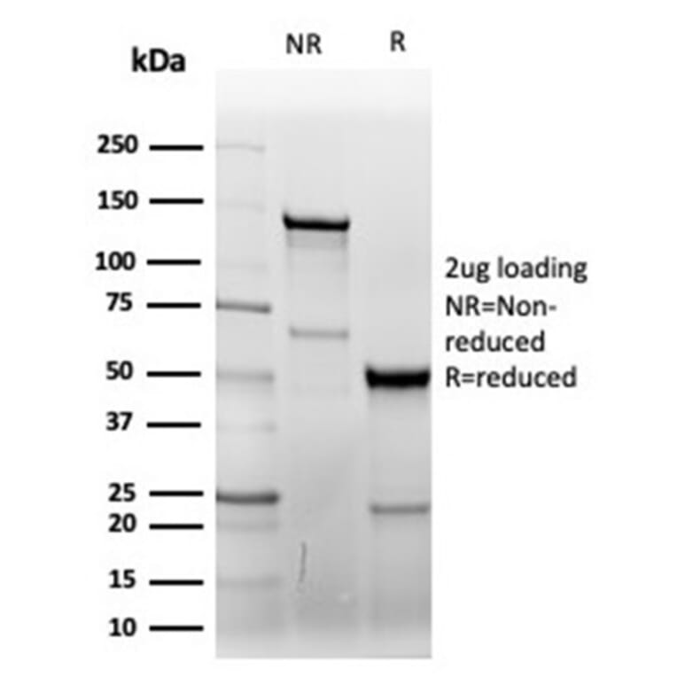 SDS-PAGE - Anti-CD7 Antibody [CD7/6388R] (A250551) - Antibodies.com