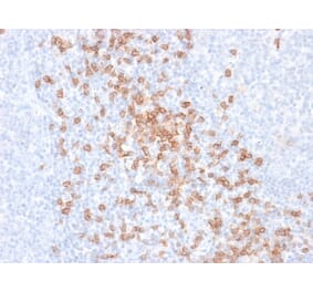 Immunohistochemistry - Anti-CD8A Antibody [rC8/468] (A250553) - Antibodies.com