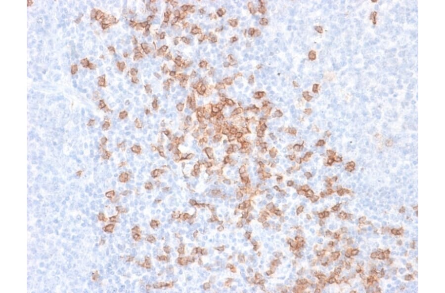 Immunohistochemistry - Anti-CD8A Antibody [rC8/468] (A250553) - Antibodies.com