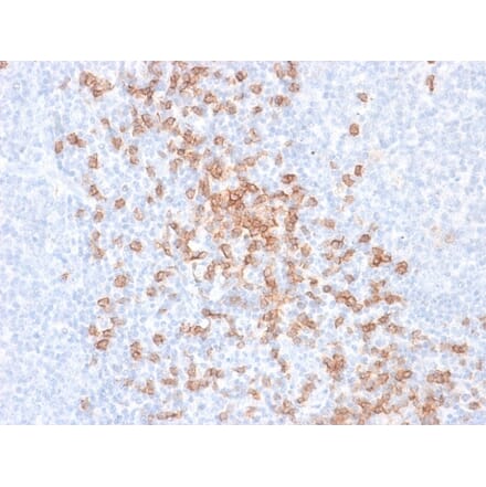 Immunohistochemistry - Anti-CD8A Antibody [rC8/468] (A250553) - Antibodies.com