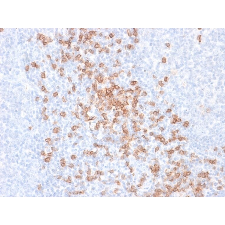 Immunohistochemistry - Anti-CD8A Antibody [rC8/468] (A250553) - Antibodies.com