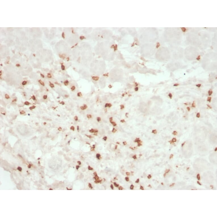 Immunohistochemistry - Anti-CD8A Antibody [rC8/468] (A250553) - Antibodies.com