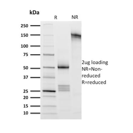 SDS-PAGE - Anti-CD8A Antibody [UCHT4] (A250554) - Antibodies.com