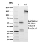 SDS-PAGE - Anti-CD8A Antibody [UCHT4] (A250554) - Antibodies.com