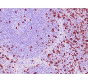 Immunohistochemistry - Anti-CD8A Antibody [C8/468] (A250555) - Antibodies.com