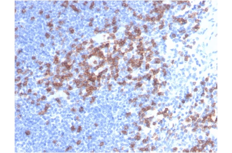Immunohistochemistry - Anti-CD8A Antibody [C8/468] (A250555) - Antibodies.com