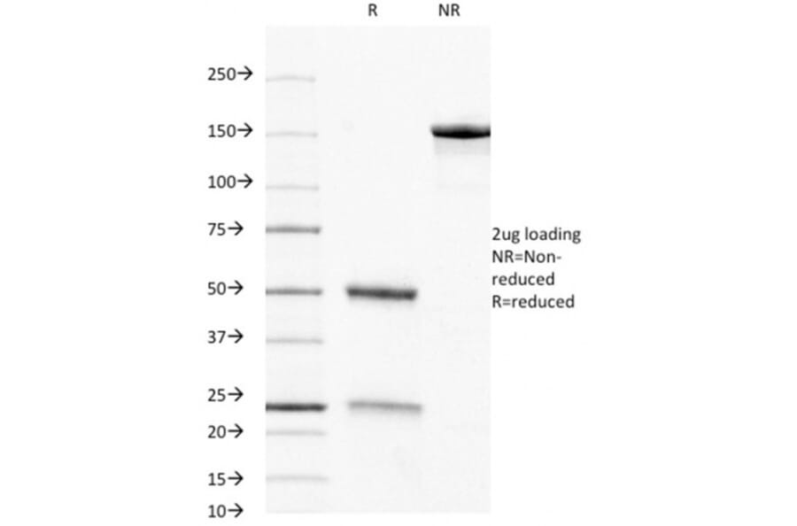 SDS-PAGE - Anti-CD8A Antibody [C8/468] (A250555) - Antibodies.com