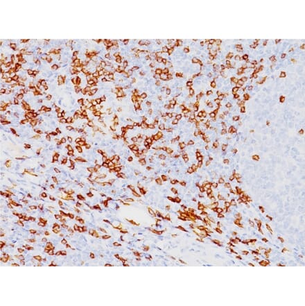 Immunohistochemistry - Anti-CD8A Antibody [SPM548] (A250555) - Antibodies.com