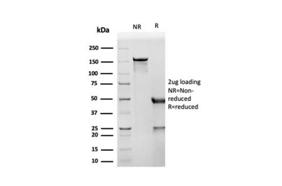 SDS-PAGE - Anti-CD8A Antibody [SPM548] (A250556) - Antibodies.com