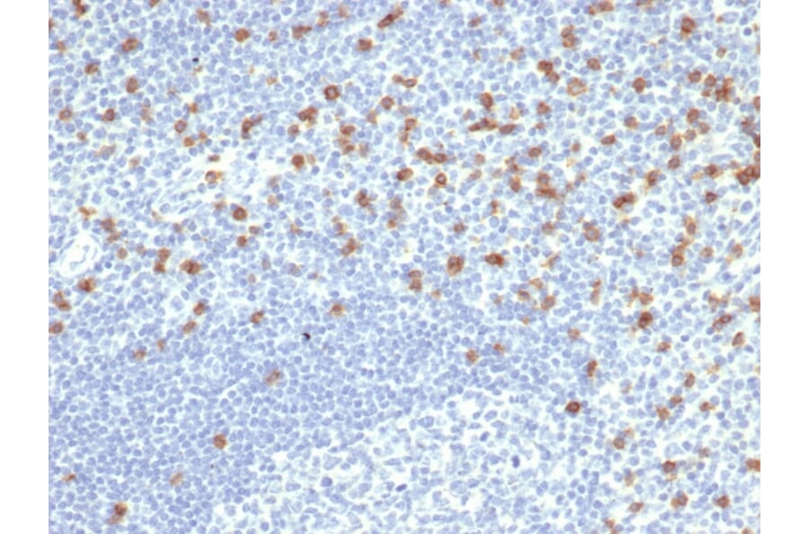 Immunohistochemistry - Anti-CD8A Antibody [rCD8/6590] (A250557) - Antibodies.com