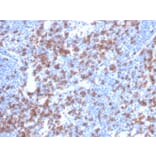 Immunohistochemistry - Anti-CD8A Antibody [rCD8/6590] (A250556) - Antibodies.com