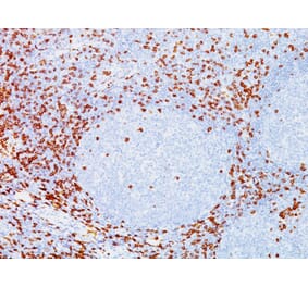 Immunohistochemistry - Anti-CD8A Antibody [C8/144B] (A250558) - Antibodies.com