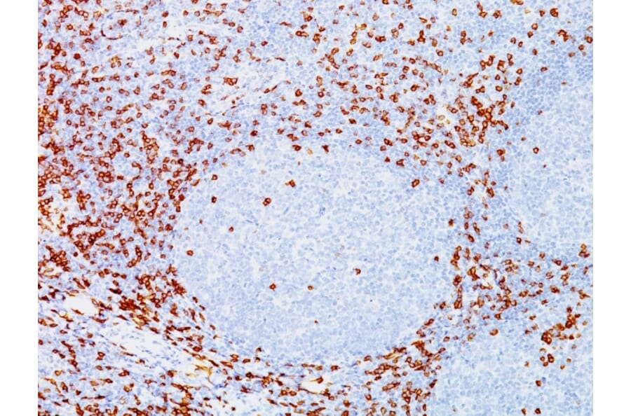 Immunohistochemistry - Anti-CD8A Antibody [C8/144B] (A250558) - Antibodies.com